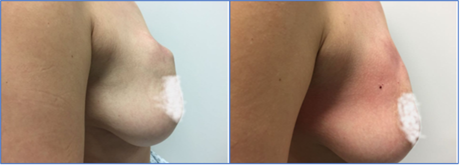 Auszeichnung Spitzenmedizin zur Thermoablation